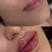 فیلر درجه یک