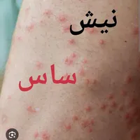 سمپاشی ساس سم پاشی سوسک در تمام نقاط تهران و حومه|خدمات نظافت|تهران, نارمک|دیوار
