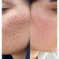 تخفیفات ویژه ۴۰٪ سالن زیبایی مریم افشار|خدمات آرایشگری و زیبایی|الوند, |دیوار