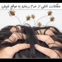 شامپو شپش و تخم شپشصد در صد تضمینی