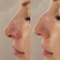 کلنیک زیبایی  لیزر تتو بدن، تزریق ژل و بوتاکس و...|خدمات آرایشگری و زیبایی|اسلام‌شهر, شهرک واوان|دیوار