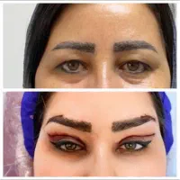 تزریق ژل و بوتاکس پکیج ۵۹۰۰ ماندگاری ۱ سال تضمینی|خدمات آرایشگری و زیبایی|تهران, تهرانپارس غربی|دیوار
