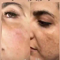 فروش و عرضه محصولات با کیفیت تراست|آرایشی، بهداشتی، درمانی|صوفیان, |دیوار