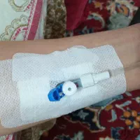 خدمات پرستار تزریقات پانسمان سوند در منزل