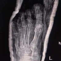 خدمات کایروپراکتیک، شکستهبندی و حجامت در محل|خدمات زیبایی و سلامت|تهران, دبستان|دیوار