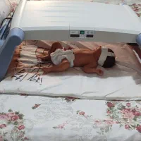اجاره دستگاه زردی نوزاد درمنزل کل تهران ارسال سریع