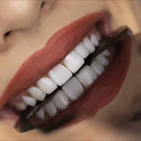 انجام کلیه خدمات دندانپزشکی و زیبایی