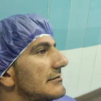 جراحی بینی توسط دکتر متخصص امیر اسدالله پور|پزشکی|قائمشهر, |دیوار