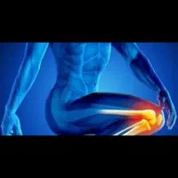 درمان آرتروز زانو/به روش پلاسما|خدمات آرایشگری و زیبایی|خرم‌آباد, |دیوار