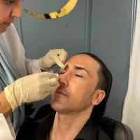 لیزر بوتاکس پی ارپی توسط دکتر|خدمات آرایشگری و زیبایی|مشهد, وکیلآباد|دیوار