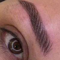 آموزش فیبروز میکروبلیدینگ(بلوارستاره)