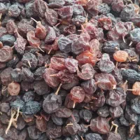 درمان سنگ کلیه در سه ساعت