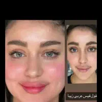 جراحی پلک و لیفت ابرو فقط 15 ملیون به مدت یک هفته
