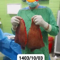 جراجی چاقی ، بای پس و اسلیو فوق تخصصی دکتریاب|خدمات آرایشگری و زیبایی|شیراز, ملاصدرا|دیوار