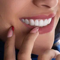 کامپوزیت دندان با ماهی ۵ تومن با چک و سفته