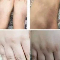 کرم سفیده کننده صددرصد تضمینی|آرایشی، بهداشتی، درمانی|رفسنجان, |دیوار