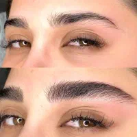 میکروبلیدینگ، فیبروز، آموزش میکروبلیدینگ