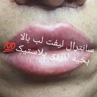 تخفیف ویژه خدمات زیبایی