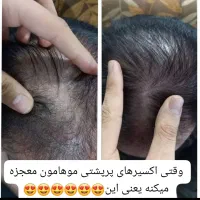 اکسیرپرپشتی مو ،مژه و ابرو|خدمات آرایشگری و زیبایی|گلبهار, شهر جدید گلبهار|دیوار