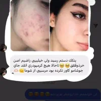 پنکک فول کاور لاکچری کوئین|آرایشی، بهداشتی، درمانی|رباط‌کریم, الارد|دیوار