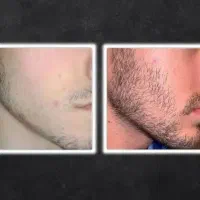 هرتار از تار قبلی ضخیم تر