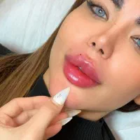کلینیک ژل وفیلربادی بوتاکس و مزو تراپی 200