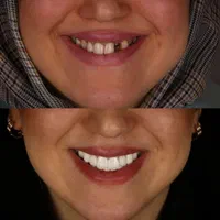دندانپزشکی توحید.کاپوزیت،لمینت، ایمپلنت|خدمات آرایشگری و زیبایی|شیراز, فرگاز|دیوار