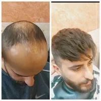 خدمات پروتز و ترمیم مو/پروتز دائم/پروتز مو|خدمات آرایشگری و زیبایی|اصفهان, باغ زیار|دیوار
