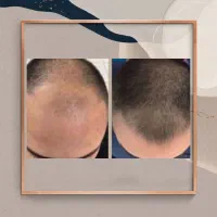 پاور بانک رویش