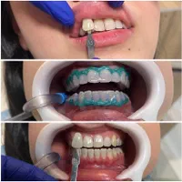 خدمات دندانپزشکی|خدمات آرایشگری و زیبایی|رشت, گلسار|دیوار