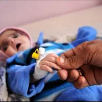 لباس بچعم گرسنه