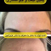 سرم لیفتینگ گاتیو|آرایشی، بهداشتی، درمانی|شیراز, طلاب|دیوار