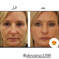 کلینیک پوست و مو|خدمات آرایشگری و زیبایی|تهران, خانی آباد نو شمالی|دیوار