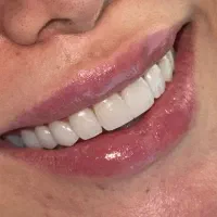 دکتر دنداپزشک زیبایی