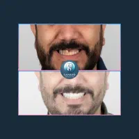 ایمپلنت دندان/فوری/دیجیتال/کاشت دندان/لمینیت|خدمات آرایشگری و زیبایی|تهران, سلسبیل شمالی|دیوار