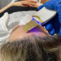 فیشال و جوانسازی پوست|خدمات آرایشگری و زیبایی|قائمشهر, |دیوار