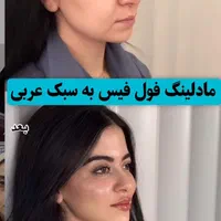 مزو،بوتاکس،چربی،فیلر،جراحی زیبایی صورت وبدن|خدمات آرایشگری و زیبایی|تهران, نارمک|دیوار