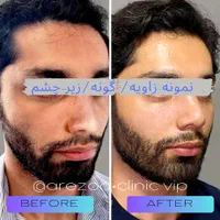 همکاری با مترجم**عربی زبان**در حوزه زیبایی پزشکی|استخدام بازاریابی و فروش|اصفهان, مرداویج|دیوار