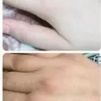 کرم سفید کننده  دستو پا