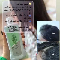 تونیک هیر فرند|مواد شوینده و دستمال کاغذی|مرند, |دیوار