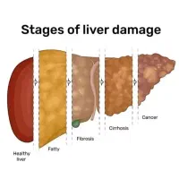 پاکسازی کبد