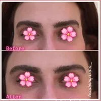 بوتاکس رایگان|خدمات آرایشگری و زیبایی|قم, زنبیل آباد|دیوار