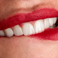 مرکز تخصصی و خصوصی دندانپزشکی با تعرفه خیریه|خدمات آرایشگری و زیبایی|شیراز, آزادگان|دیوار