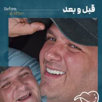دندانپزشکی/ مرکز ایمپلنت دیجیتال 6800|خدمات آرایشگری و زیبایی|تهران, پاسداران|دیوار