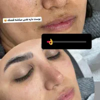 آموزش فیشیال پاکسازی پوست تخفیف بلک فرایدی|خدمات آموزشی|کرمانشاه, |دیوار