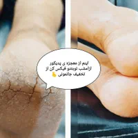 پدیکور|خدمات آرایشگری و زیبایی|سنقر, |دیوار