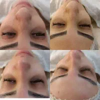 پاکسازی و فشیال پوست|خدمات آرایشگری و زیبایی|قم, حنیف نژاد|دیوار