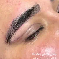 بلفاروپلاستی تخفیف ویژه ساکشن غبغب سوپرکانتورینگ|خدمات آرایشگری و زیبایی|اهواز, کیان اباد|دیوار