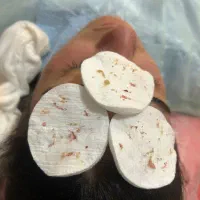 آموزش پاکسازی پوست