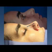 جراحی و عمل زیبایی بینی و لیپو و بلفاروپلاستی|خدمات آرایشگری و زیبایی|نسیم‌شهر, |دیوار